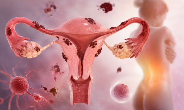 MP invita al Encuentro médico «Endometriosis: diagnóstico y tratamiento actual»