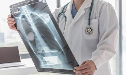 Presentación sobre tuberculosis en personas privadas de libertad: un enfoque desde los derechos humanos