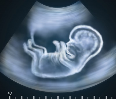 Aborto: TCA suspende 11 artículos de la ley por su «daño» a médicos