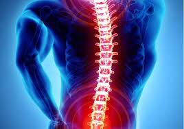 Espondiloartritis Axial: cuando un simple dolor de espalda se vuelve una enfermedad reumática